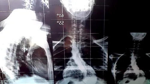 Appel à la solidarité pour sauver le jeune Rayane atteint d’une...